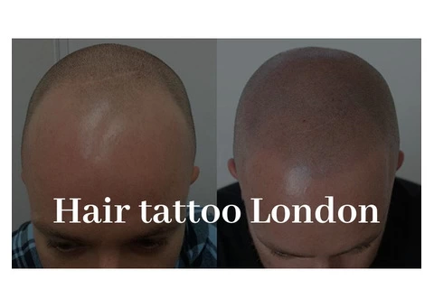 Hair Tattoo For Men in The UK - 2/3