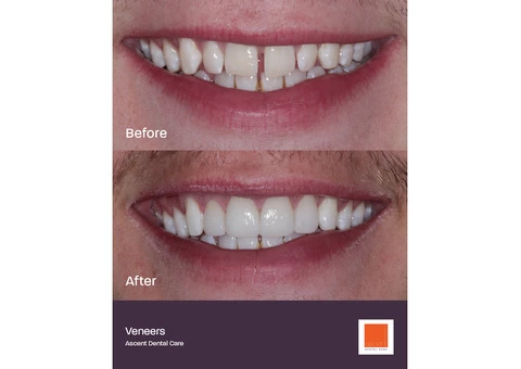 Ascent Dental Care Leamington Spa - 5/8