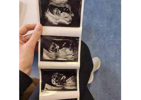 Reassurance for Scanning Services in Cardiff Book Your Appointment