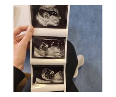 Reassurance for Scanning Services in Cardiff Book Your Appointment