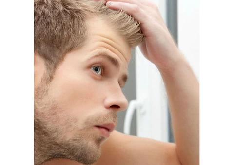 Hair Loss Solutions For Men in The UK - 2/2