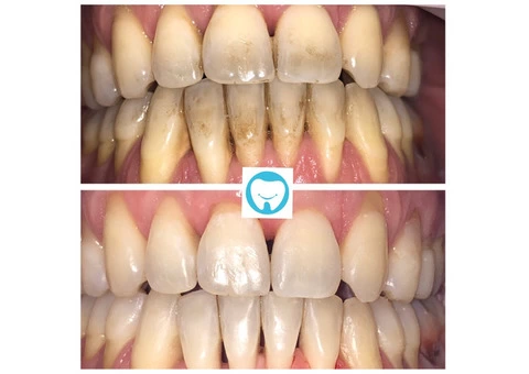 Chelsea Dental Clinic - 2/11