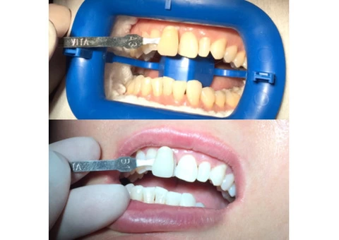 Chelsea Dental Clinic - 5/11