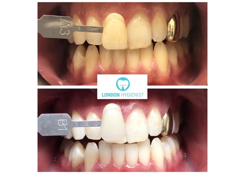 Chelsea Dental Clinic - 6/11