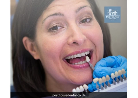 What are the top options for permanent tooth replacement at Post House Dental?
