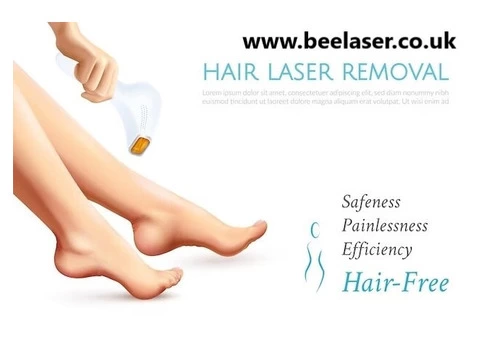 Elegance Uncovered | Hair Removal Experiences in Harrow