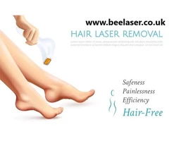 Elegance Uncovered | Hair Removal Experiences in Harrow