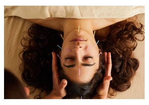 Promoting Wellness through Acupuncture Bromley, London