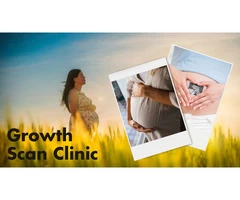 Nurture Your Baby's Growth with Window To The Womb's Growth Scan Clinic in Cardiff!