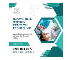 Laser Hair Removal London