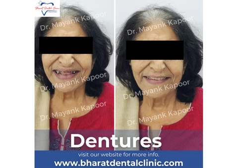 Get best smile designing treatment at affordable cost.