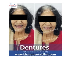 Get best smile designing treatment at affordable cost.