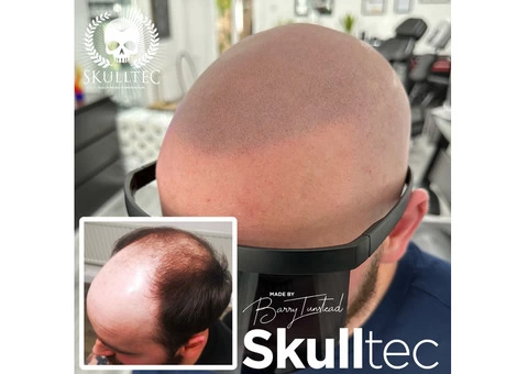 SMP For Men in The UK