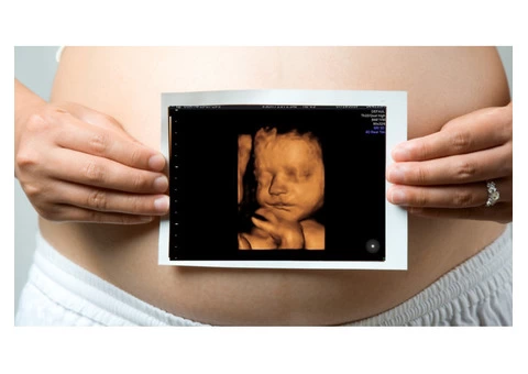 Get A Fetal Well Being Scan From Window To The Womb In Watford