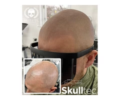 SMP (Hair Tattoo) Can Transform Your Appearance