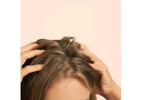 Menopausal Hair Loss Solution In Scotland