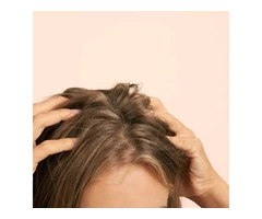 Menopausal Hair Loss Solution In Scotland