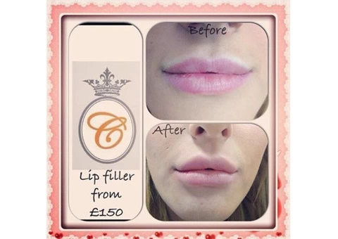 Best Botox and Lip Filler in Leeds - 1/7