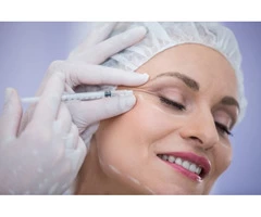 Botox Bexleyheath