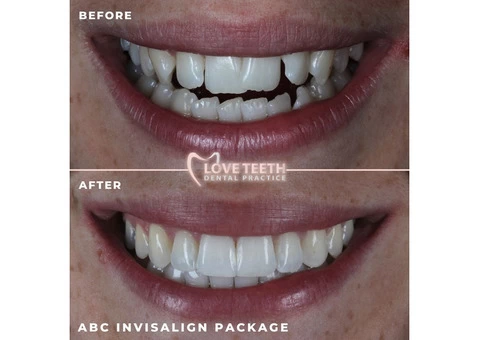 Love Teeth Dental - Stonecot - 3/4