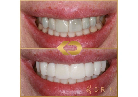 Kissdental Knutsford - 1/11