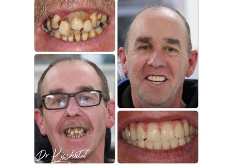 Kissdental Knutsford - 2/11