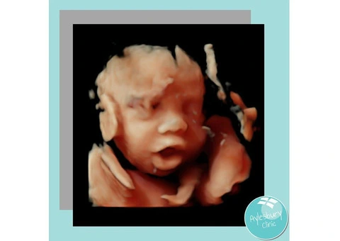 Get The Best 4D Baby Scans From Private Ultrasound Scan In Aylesbury Clinic