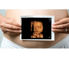 Growth Scan Clinic In Watford - Monitor Your Baby's Development