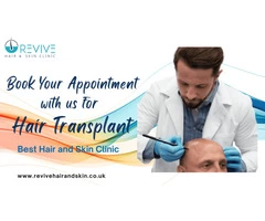 Get the Best Hair Transplant Surgery