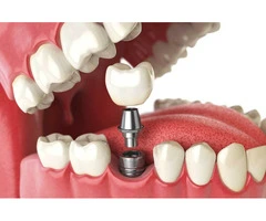 Have you been prioritizing your oral health?