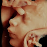 baby scanning