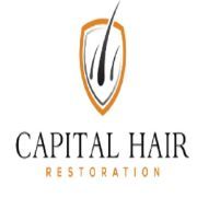 Capital Hair Restoration